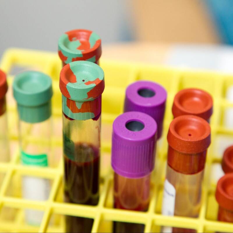 Coloured vials with liquid content