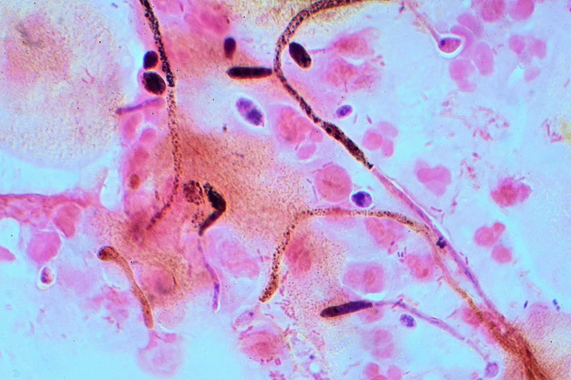 Candida albicans visualised using optical microscopy