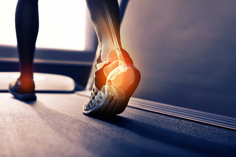 Person walking on a treadmill with their achilles tendon highlighted through the skin